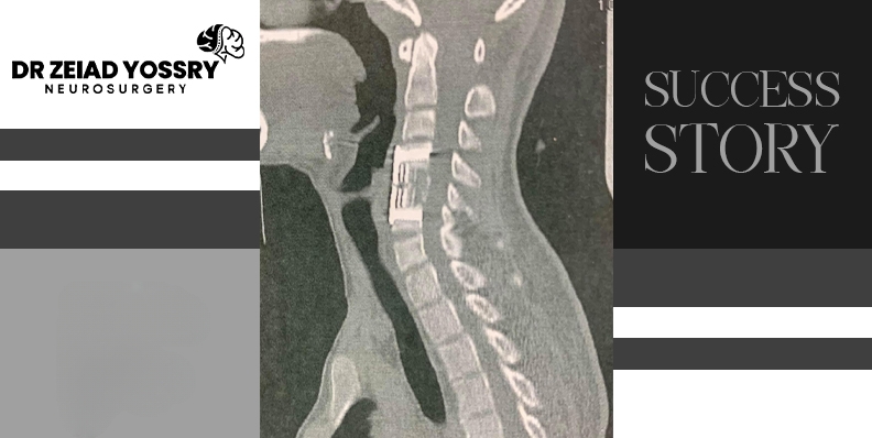 Young-Yemeni-Man-Regains-Movement-After-Quadriplegia